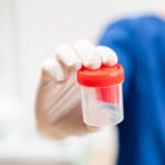 doctor in blue uniform and latex gloves is holding an empty plastic container for taking urine samples, light background. Medical concept.